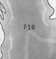 Thumbnail for version as of 22:08, 10 January 2025