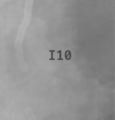 Thumbnail for version as of 22:11, 10 January 2025